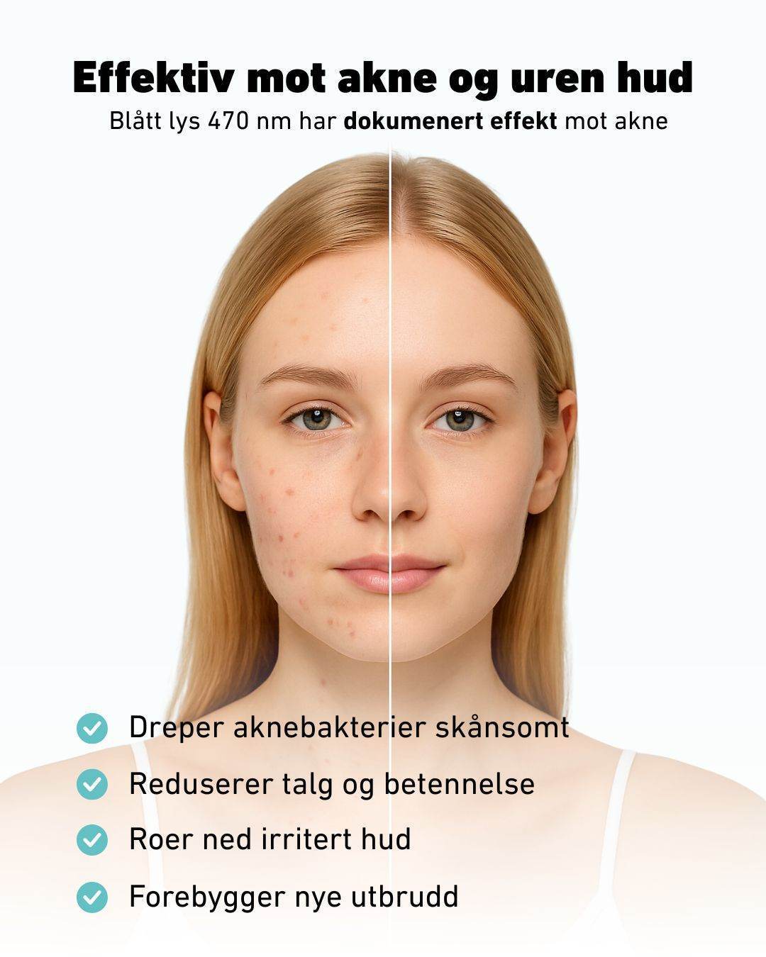 LED-lysmaske til ansikt mot akne, rynker og pigmentflekker - Image 7